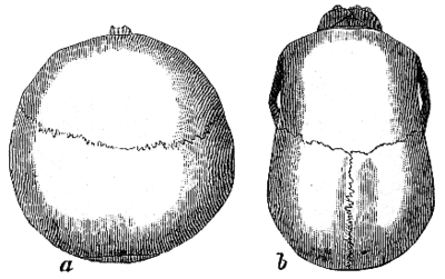 Cranio brachicefalo (a) e dolicocefalo (b)